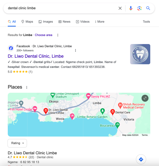 Screenshot of a Google search results page for "dental clinic limbe," showing listings for "Dr. Liwo Dental Clinic, Limbe" on Facebook, with contact information and a map location. The map highlights various places in Limbe, with the clinic's position marked, a convenient option for local dental work.